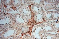 GSTT1 Rabbit anti-Human, Mouse, Rat, Polyclonal, Proteintech 150 &mu;L;