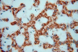 GSTT1 Rabbit anti-Human, Mouse, Rat, Polyclonal, Proteintech 150 &mu;L;