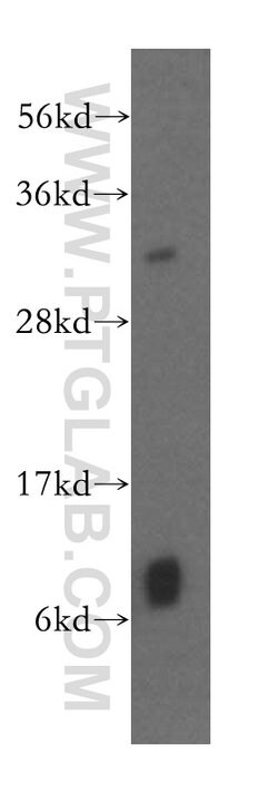 GSTT1 Rabbit anti-Human, Mouse, Rat, Polyclonal, Proteintech 150 &mu;L;