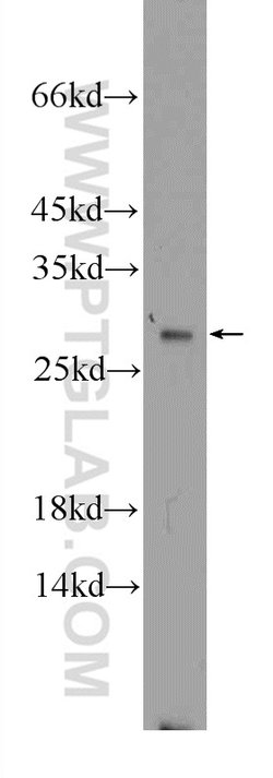 GSTT1 Rabbit anti-Human, Mouse, Rat, Polyclonal, Proteintech 150 &mu;L;