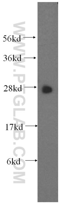 GSTT1 Rabbit anti-Human, Mouse, Rat, Polyclonal, Proteintech 150 &mu;L;