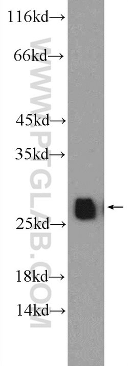 GSTT1 Rabbit anti-Human, Mouse, Rat, Polyclonal, Proteintech 150 &mu;L;