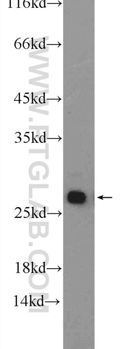 GSTT1 Rabbit anti-Human, Mouse, Rat, Polyclonal, Proteintech 150 &mu;L;
