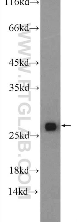 GSTT1 Rabbit anti-Human, Mouse, Rat, Polyclonal, Proteintech 150 &mu;L;