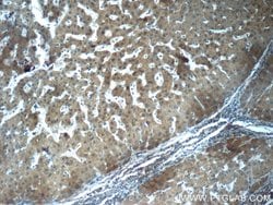 Fibrinogen gamma chain Rabbit anti-Human, Mouse, Rat, Polyclonal, Proteintech