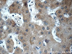 Fibrinogen gamma chain Rabbit anti-Human, Mouse, Rat, Polyclonal, Proteintech:Antibodies:Primary