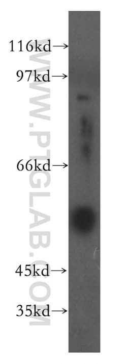 Fibrinogen gamma chain Rabbit anti-Human, Mouse, Rat, Polyclonal, Proteintech:Antibodies:Primary