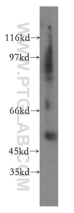 Fibrinogen gamma chain Rabbit anti-Human, Mouse, Rat, Polyclonal, Proteintech:Antibodies:Primary