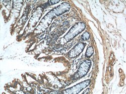 NDUFS4 Rabbit anti-Human, Mouse, Rat, Polyclonal, Proteintech 150 &mu;L;