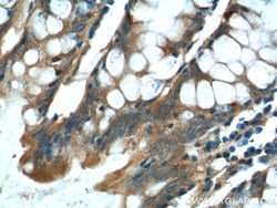 NDUFS4 Rabbit anti-Human, Mouse, Rat, Polyclonal, Proteintech 150 &mu;L;