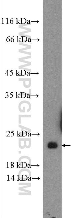 NDUFS4 Rabbit anti-Human, Mouse, Rat, Polyclonal, Proteintech 150 &mu;L;