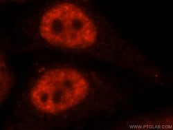 SF3A1 Rabbit anti-Human, Mouse, Rat, Polyclonal, Proteintech 150 &mu;L;