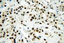 SF3A1 Rabbit anti-Human, Mouse, Rat, Polyclonal, Proteintech 150 &mu;L;