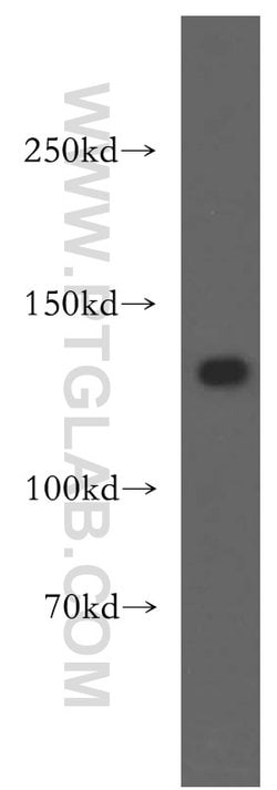 SF3A1 Rabbit anti-Human, Mouse, Rat, Polyclonal, Proteintech 150 &mu;L;