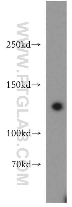 SF3A1 Rabbit anti-Human, Mouse, Rat, Polyclonal, Proteintech 150 &mu;L;