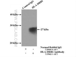 HLA-DRB1 Rabbit anti-Human, Polyclonal, Proteintech:Antibodies:Primary