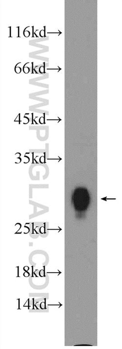 HLA-DRB1 Rabbit anti-Human, Polyclonal, Proteintech:Antibodies:Primary