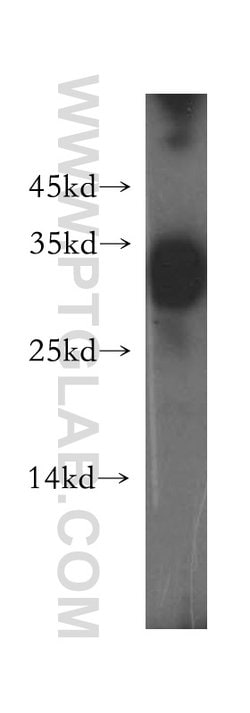 HLA-DRB1 Rabbit anti-Human, Polyclonal, Proteintech:Antibodies:Primary