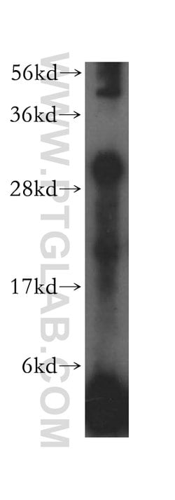 HLA-DRB1 Rabbit anti-Human, Polyclonal, Proteintech:Antibodies:Primary