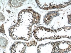 SSX4 Rabbit anti-Human, Polyclonal, Proteintech:Antibodies:Primary Antibodies