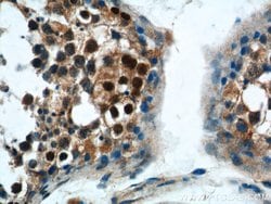 SSX4 Rabbit anti-Human, Polyclonal, Proteintech:Antibodies:Primary Antibodies