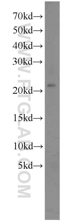 SSX4 Rabbit anti-Human, Polyclonal, Proteintech:Antibodies:Primary Antibodies