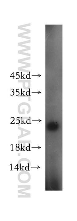 SSX4 Rabbit anti-Human, Polyclonal, Proteintech:Antibodies:Primary Antibodies