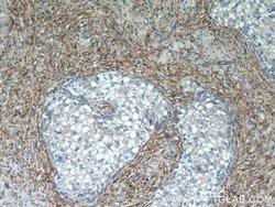PPP2R1A Rabbit anti-Human, Mouse, Rat, Polyclonal, Proteintech 150 &mu;L;