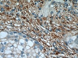 PPP2R1A Rabbit anti-Human, Mouse, Rat, Polyclonal, Proteintech 150 &mu;L;