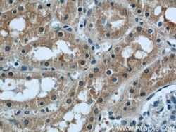 PPP2R1A Rabbit anti-Human, Mouse, Rat, Polyclonal, Proteintech 150 &mu;L;