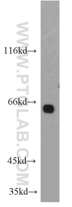 PPP2R1A Rabbit anti-Human, Mouse, Rat, Polyclonal, Proteintech 150 &mu;L;