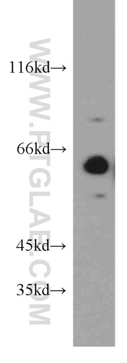 PPP2R1A Rabbit anti-Human, Mouse, Rat, Polyclonal, Proteintech 150 &mu;L;