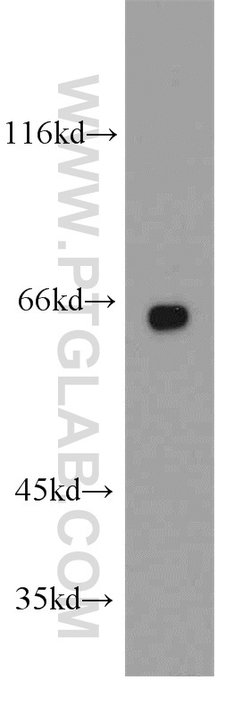 PPP2R1A Rabbit anti-Human, Mouse, Rat, Polyclonal, Proteintech 150 &mu;L;