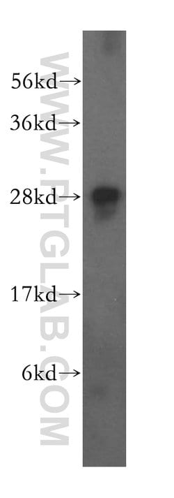 FKBP14 Rabbit anti-Human, Mouse, Rat, Polyclonal, Proteintech 150 &mu;L;
