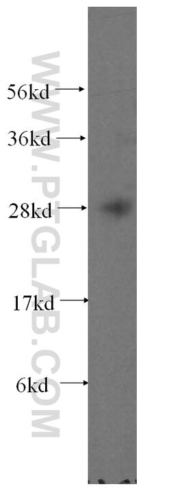 FKBP14 Rabbit anti-Human, Mouse, Rat, Polyclonal, Proteintech 150 &mu;L;