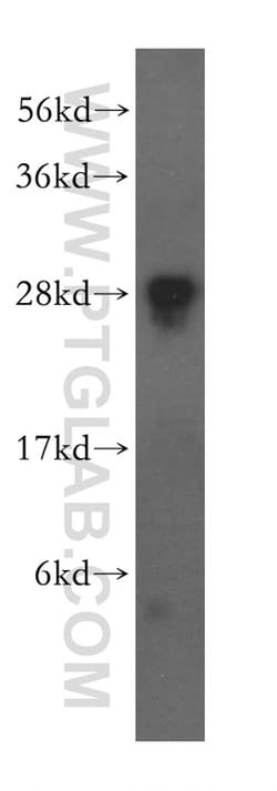 FKBP14 Rabbit anti-Human, Mouse, Rat, Polyclonal, Proteintech 150 &mu;L;