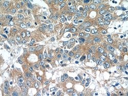 MOBKL3 Rabbit anti-Human, Mouse, Rat, Polyclonal, Proteintech:Antibodies:Primary