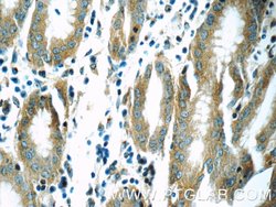 MOBKL3 Rabbit anti-Human, Mouse, Rat, Polyclonal, Proteintech:Antibodies:Primary