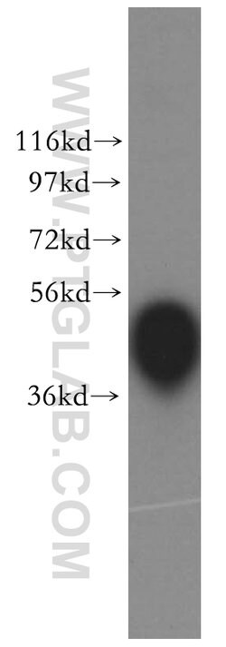 CKM/CKB Rabbit anti-Human, Mouse, Rat, Polyclonal, Proteintech:Antibodies:Primary