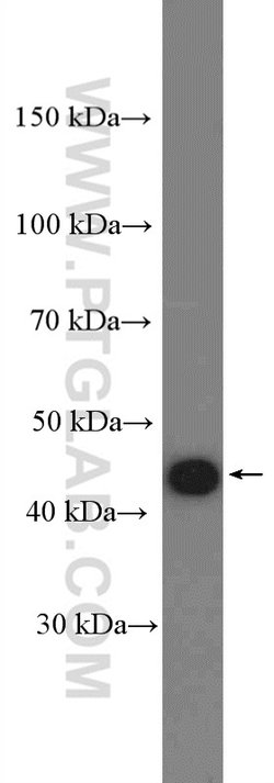 CKM/CKB Rabbit anti-Human, Mouse, Rat, Polyclonal, Proteintech:Antibodies:Primary