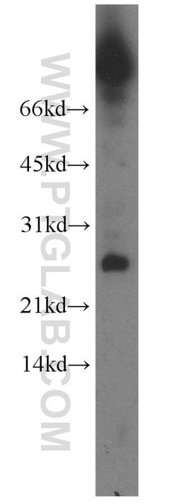 CALML4 Rabbit anti-Human, Mouse, Rat, Polyclonal, Proteintech:Antibodies:Primary