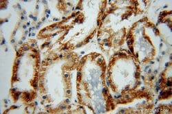 ACTO9 Rabbit anti-Human, Mouse, Rat, Polyclonal, Proteintech 150 &mu;L;