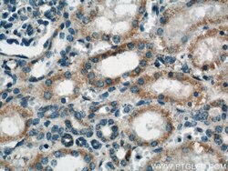 ACTO9 Rabbit anti-Human, Mouse, Rat, Polyclonal, Proteintech 150 &mu;L;