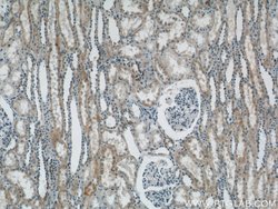 ACTO9 Rabbit anti-Human, Mouse, Rat, Polyclonal, Proteintech 150 &mu;L;