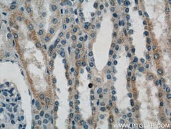 ACTO9 Rabbit anti-Human, Mouse, Rat, Polyclonal, Proteintech 150 &mu;L;