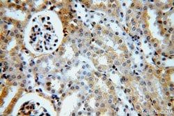 ACTO9 Rabbit anti-Human, Mouse, Rat, Polyclonal, Proteintech 150 &mu;L;