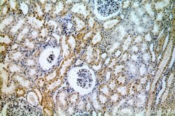 ACTO9 Rabbit anti-Human, Mouse, Rat, Polyclonal, Proteintech 150 &mu;L;