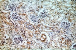 ACTO9 Rabbit anti-Human, Mouse, Rat, Polyclonal, Proteintech 150 &mu;L;