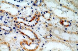ACTO9 Rabbit anti-Human, Mouse, Rat, Polyclonal, Proteintech 150 &mu;L;