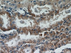 ACTO9 Rabbit anti-Human, Mouse, Rat, Polyclonal, Proteintech 150 &mu;L;